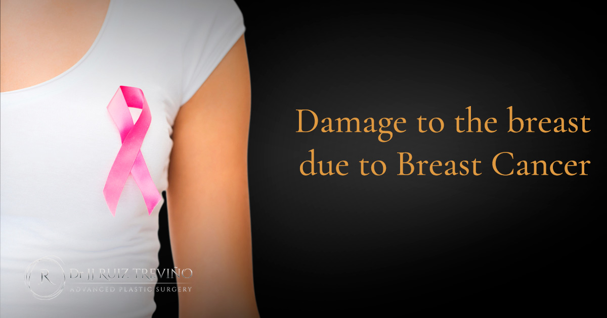 breast-augmentation-damage-cancer-dr-jj-ruiz
