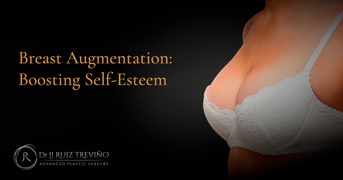 breast-augmentation-price-monterrey-dr-jj-ruiz-self-esteem