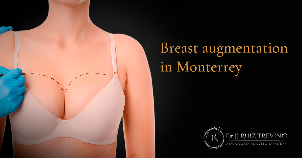 breast-augmentation-price-monterrey-dr-jj-ruiz